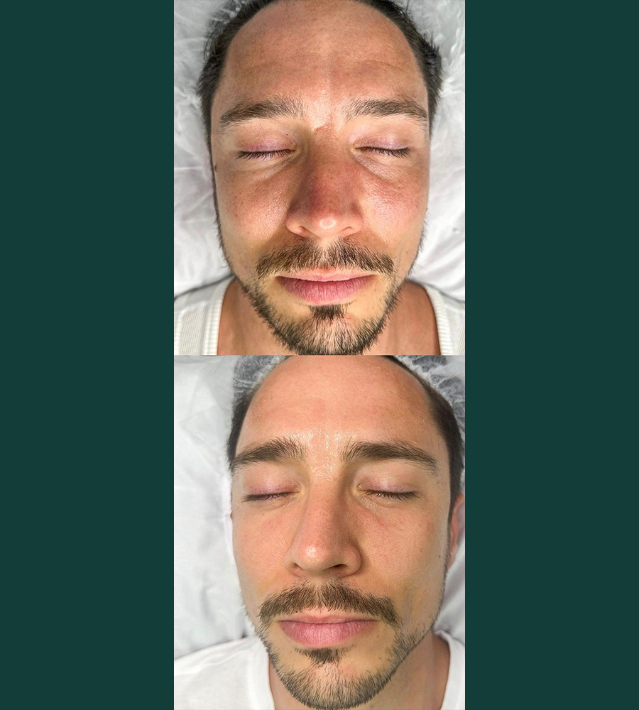 Radiance Skin